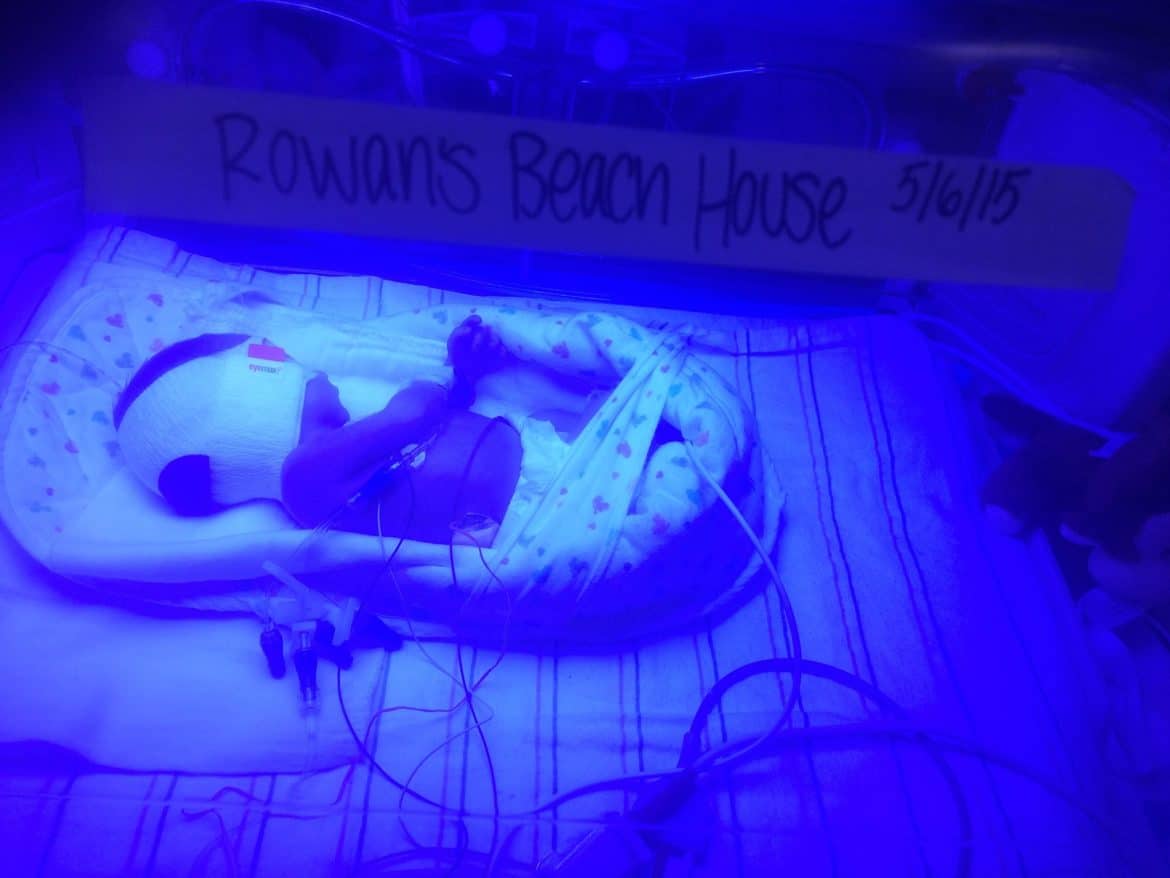 baby being treated for jaundice with blue light